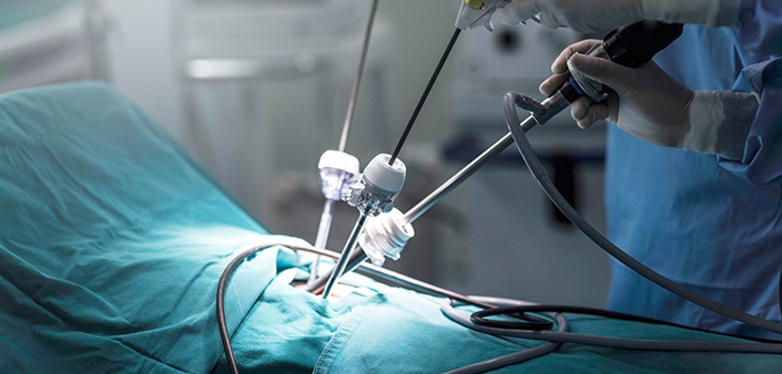 Paediatric Laparoscopy Paediatric Laparoscopy